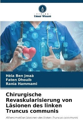 Hèla Ben Jmaà, Faten Dhouib, Rania Hammami - Chirurgische Revaskularisierung von Läsionen des linken Truncus communis, Häftad. Tillgänglighet: Lägg i varukorg