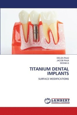 Delsa Raju, Jacob Raja, Seema G - Titanium Dental Implants, Häftad
