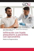 Infiltracin con lisado plaquetario a pacientes con epicondilitis