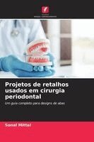 Sonal Mittal - Projetos de retalhos usados ¿¿em cirurgia periodontal, Häftad