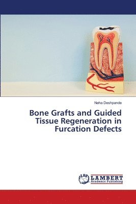 Neha Deshpande - Bone Grafts and Guided Tissue Regeneration in Furcation Defects, Häftad