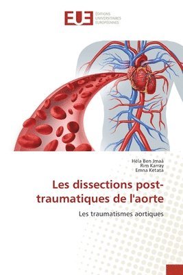 Hèla Ben Jmaà, Rim Karray, Emna Ketata - Les dissections post-traumatiques de l'aorte, Häftad. Tillgänglighet: Lägg i varukorg