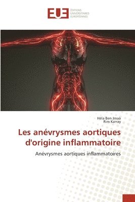 Hèla Ben Jmaà, Rim Karray - Les anévrysmes aortiques d'origine inflammatoire, Häftad. Tillgänglighet: Lägg i varukorg