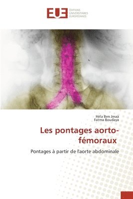 Hèla Ben Jmaà, Fatma Boudaya - Les pontages aorto-fémoraux, Häftad. Tillgänglighet: Lägg i varukorg