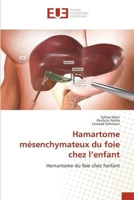 Salma Mani, Kechich Nahla, Lassaad Sahnoun - Hamartome mésenchymateux du foie chez l'enfant, Häftad. Tillgänglighet: Lägg i varukorg