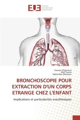 Sawsen Chakroun, Afef Toumi, Maha Ben Mansour - Bronchoscopie Pour Extraction d'Un Corps Etrange Chez l'Enfant, Häftad. Tillgänglighet: Lägg i varukorg
