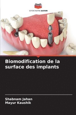 Shabnam Jahan, Mayur Kaushik - Biomodification de la surface des implants, Häftad. Tillgänglighet: Lägg i varukorg