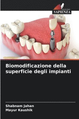 Shabnam Jahan, Mayur Kaushik - Biomodificazione della superficie degli impianti, Häftad. Tillgänglighet: Lägg i varukorg