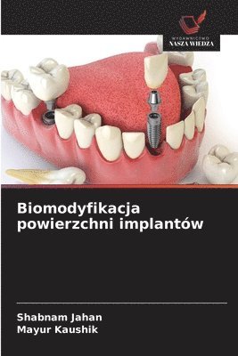 Shabnam Jahan, Mayur Kaushik - Biomodyfikacja powierzchni implantów, Häftad. Tillgänglighet: Lägg i varukorg