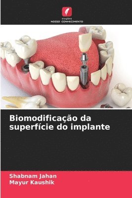 Shabnam Jahan, Mayur Kaushik - Biomodificação da superfície do implante, Häftad. Tillgänglighet: Lägg i varukorg