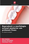 Reproduzir a morfologia oclusal posterior em prteses fixas