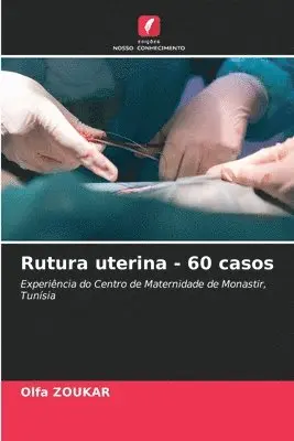 Olfa Zoukar - Rutura uterina - 60 casos, Häftad. Tillgänglighet: Lägg i varukorg
