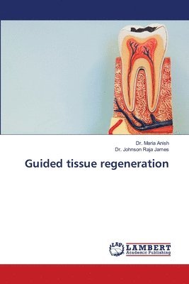Maria Anish, Johnson Raja James - Guided tissue regeneration, Häftad
