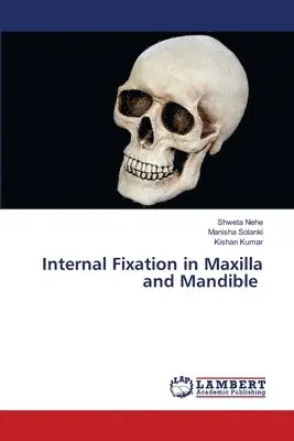 Shweta Nehe, Manisha Solanki, Kishan Kumar - Internal Fixation in Maxilla and Mandible, Häftad. Tillgänglighet: Lägg i varukorg