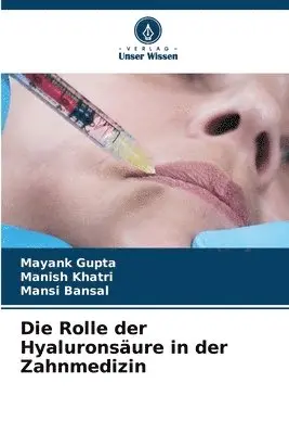 Mayank Gupta, Manish Khatri, Mansi Bansal - Rolle der Hyaluronsäure in der Zahnmedizin, Häftad. Tillgänglighet: Lägg i varukorg