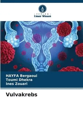 Hayfa Bergaoui, Toumi Dhekra, Ines Zouari - Vulvakrebs, Häftad. Tillgänglighet: Lägg i varukorg