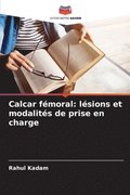 Calcar fémoral