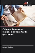 Calcare femorale