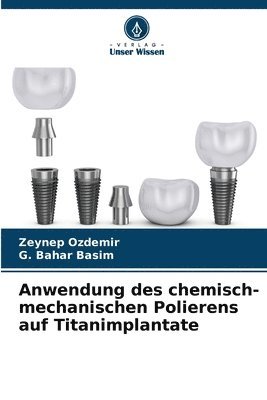 Zeynep Ozdemir, G Bahar Basim - Anwendung des chemisch-mechanischen Polierens auf Titanimplantate, Häftad