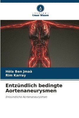 Hèla Ben Jmaà, Rim Karray - Entzündlich bedingte Aortenaneurysmen, Häftad. Tillgänglighet: Lägg i varukorg