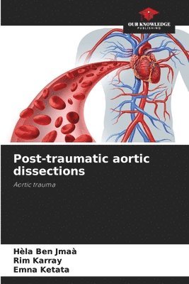 Hèla Ben Jmaà, Rim Karray, Emna Ketata - Post-traumatic aortic dissections, Häftad. Tillgänglighet: Lägg i varukorg