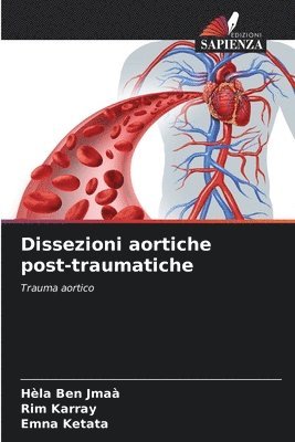 Hèla Ben Jmaà, Rim Karray, Emna Ketata - Dissezioni aortiche post-traumatiche, Häftad
