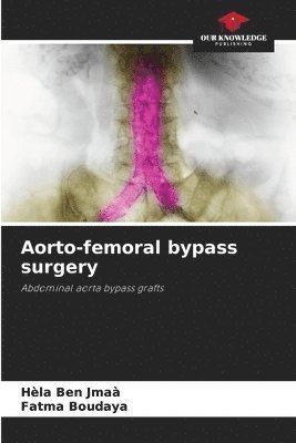 Hèla Ben Jmaà, Fatma Boudaya - Aorto-femoral bypass surgery, Häftad