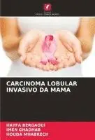 Hayfa Bergaoui, Imen Ghadhab, Houda Mhabrech - Carcinoma Lobular Invasivo Da Mama, Häftad. Tillgänglighet: Lägg i varukorg