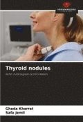 Thyroid nodules