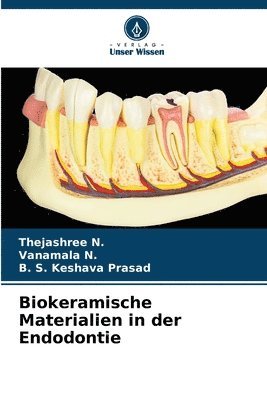 Thejashree N, Vanamala N, B S Keshava Prasad - Biokeramische Materialien in der Endodontie, Häftad. Tillgänglighet: Lägg i varukorg