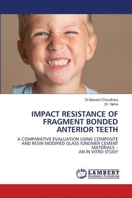 Dr Basant Choudhary, Neha - Impact Resistance of Fragment Bonded Anterior Teeth, Häftad. Tillgänglighet: Lägg i varukorg