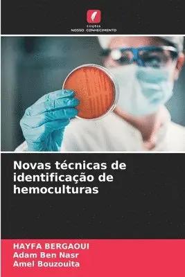 Hayfa Bergaoui, Adam Ben Nasr, Amel Bouzouita - Novas técnicas de identificação de hemoculturas, Häftad. Tillgänglighet: Lägg i varukorg