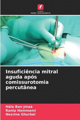 Hèla Ben Jmaà, Rania Hammami, Nesrine Ghorbel - Insuficiência mitral aguda após comissurotomia percutânea, Häftad