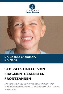 Basant Choudhary, Neha - Stossfestigkeit Von Fragmentgeklebten Frontzähnen, Häftad. Tillgänglighet: Lägg i varukorg