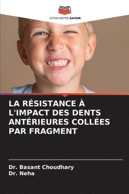 Basant Choudhary, Neha - Résistance À l'Impact Des Dents Antérieures Collées Par Fragment, Häftad. Tillgänglighet: Lägg i varukorg