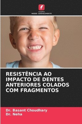 Basant Choudhary, Neha - Resistência Ao Impacto de Dentes Anteriores Colados Com Fragmentos, Häftad. Tillgänglighet: Lägg i varukorg