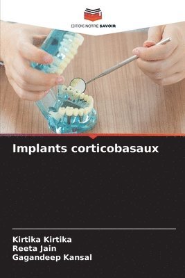 Kirtika Kirtika, Reeta Jain, Gagandeep Kansal - Implants corticobasaux, Häftad
