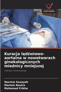 Kuracja l&#281;d&#378;wiowo-aortalna w nowotworach ginekologicznych miednicy mniejszej
