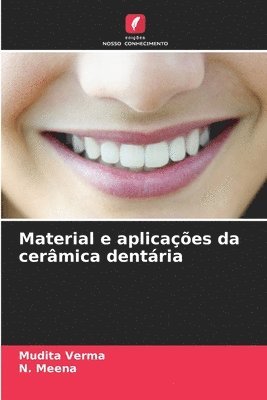 Mudita Verma, N Meena - Material e aplicações da cerâmica dentária, Häftad. Tillgänglighet: Lägg i varukorg
