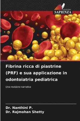 Nanthini P, Rajmohan Shetty - Fibrina ricca di piastrine (PRF) e sua applicazione in odontoiatria pediatrica, Häftad. Tillgänglighet: Lägg i varukorg