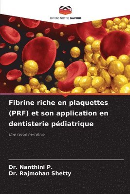 Nanthini P, Rajmohan Shetty - Fibrine riche en plaquettes (PRF) et son application en dentisterie pédiatrique, Häftad. Tillgänglighet: Lägg i varukorg