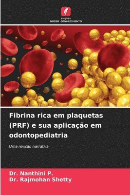 Nanthini P, Rajmohan Shetty - Fibrina rica em plaquetas (PRF) e sua aplicação em odontopediatria, Häftad. Tillgänglighet: Lägg i varukorg