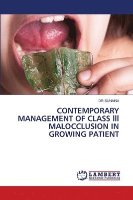 Sunaina - CONTEMPORARY MANAGEMENT OF CLASS lll MALOCCLUSION IN GROWING PATIENT, Häftad
