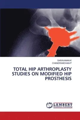 Saravanan K, Chandramohan P - Total Hip Arthroplasty Studies on Modified Hip Prosthesis, Häftad. Tillgänglighet: Lägg i varukorg