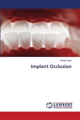 Abhijit Singh - Implant Occlusion, Häftad. Tillgänglighet: Lägg i varukorg