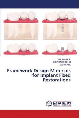 Varshini K R, Jyot Kaur Kohli, Ashwini K - Framework Design Materials for Implant Fixed Restorations, Häftad. Tillgänglighet: Lägg i varukorg