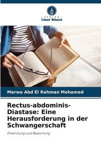 Rectus-abdominis-Diastase