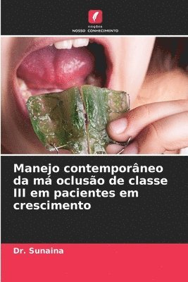 Sunaina - Manejo contemporâneo da má oclusão de classe III em pacientes em crescimento, Häftad