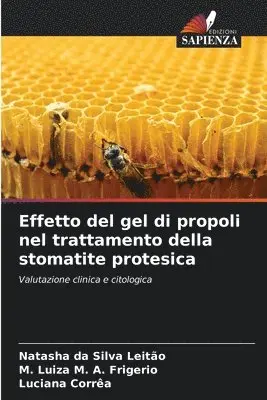 Natasha Da Silva Leitão, M Luiza M A Frigerio, Luciana Corrêa - Effetto del gel di propoli nel trattamento della stomatite protesica, Häftad. Tillgänglighet: Lägg i varukorg