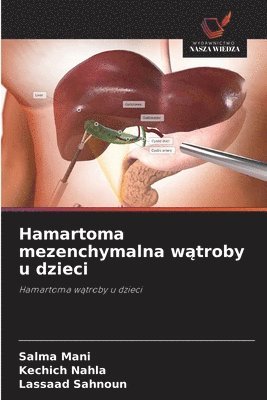 Salma Mani, Kechich Nahla, Lassaad Sahnoun - Hamartoma mezenchymalna wątroby u dzieci, Häftad. Tillgänglighet: Lägg i varukorg